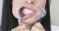 【✅ 当日限定‼️】歯の黄ばみにセルフホワイトニング体験メニュー🦷✨8分×2回で効果実感😉!セルフで簡単本格ケア🌿