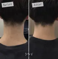 【メンズ脱毛U28限定✨】メンズうなじ脱毛 1回お試し1000円💁🏻♂️
