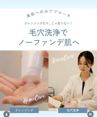 【2回目以降】超音波洗浄（カウンセリング含む）