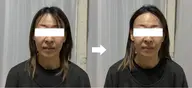 すっきりしたい時＊大事な日の前などに＊ドライヘッドマッサージ💆‍♀️