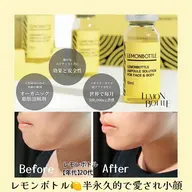 【小顔フェイシャル】韓国美容レモンBottle&EMS+デコルテマッサージコース