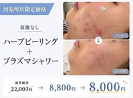 【河原町店限定|ニキビ悩み人気No.1☆】プラズマ×剥離無しハーブピーリング
