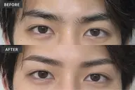 3名限定!メンズ眉毛ワックス脱毛モデル