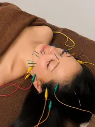 【迷ったらこれ】人気No.1✨ 美容鍼プレミアムコース