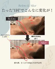 【平日限定★目元パッチリ】眼精疲労スッキリ美容鍼+お疲れ顔解消マッサージ(クマ・エラ・食いしばり)
