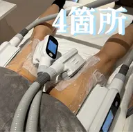 【現金限定】脂肪れい却4カップ★ヒップ/太もも/ふくらはぎから選べます!¥22,000▶︎¥8,800 さらにお得に!