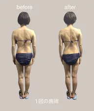 【2名限定/全6回】週1ペースでご協力いただける方⭐️夏までに美ボディ!全身筋膜リリース60分×6回 ¥35,000