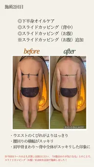 【お得】下半身オイルケア+背中スライドカッピング