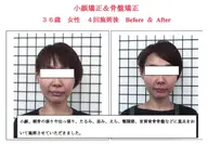 小顔効果を徹底キープ★本格小顔整体+筋膜整体+骨盤整体