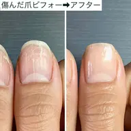 【シンプル綺麗な自爪風】自爪育成ネイルケア+プロのギタリスト用補強コート仕上げ70分🌿 #深爪 #二枚爪 #噛み爪