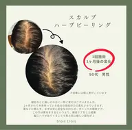 【先着10名様無料モニター】頭皮が気になり始めてきた方へ頭皮ケア　必ず2回ご来店頂ける方限定