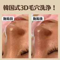 韓国式3D毛穴洗浄!長野県2店舗のみ✨️諏訪地域で施術できるのは当店のみです😊症例写真はInstagramに◎
