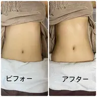 遺伝子ケア