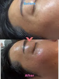 フェイシャルWax◆ヌクレールワックス=脱毛のための行程ではなく「美肌を作る行程」で仕上がりの美しさと肌負担を最低限に。