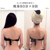 【ご新規様限定30%OFF】お好きな箇所をしっかりと✨トリプル溶解痩身90分
