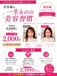 ✨️💃美容鍼モニター募集💃✨️通常6,000円 → モニター価格2,000円【3回まで利用可能】