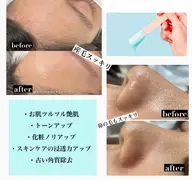 【産毛角質ケア★即ツルツル】フェイシャルワックス+うるおいパック付￥6,980→¥4,980