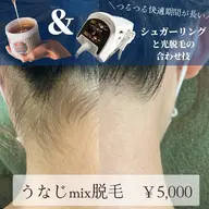 後ろ姿美人✨うなじシュガーリング×最新式光脱毛の合わせ技！mix脱毛でつるつる長持ち👶💓デザイン込み
