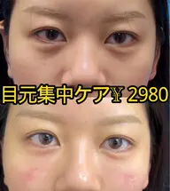 ［目集中ケア］眼精疲労＆シワ改善＆リフトアップ🌸キャピ+コラーゲン導入+ハンドマッサージ🌸40分