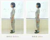 美姿勢矯正コース(スマホ首、巻き肩、猫背、肩こり、腰がつらい方、姿勢が悪くカラダの歪みが気になる方にオススメ)