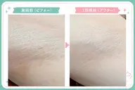 【新規の方】レディース・メンズ両ワキ脱毛¥4,000→¥2,000