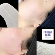 【産毛&毛穴・角質ケア✨】低刺激⭐️マリムーブ全顔ワックス💆‍♀️