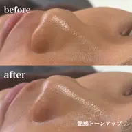 【🎗️ここでしか受けられない】艶モチ肌感動レベルの透明感フルコース（ハイドラ×フェイシャルワックス×ビタミンC導入）