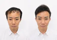 顔出し有りモデル募集【薄毛に悩む男性専門】カット