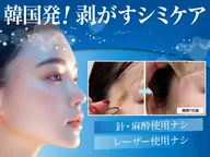 シミにお悩みの方に！シミがペロリ！最新韓国式シミケア　ホワイトラボ　１５分取り放題
