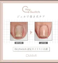👣フット専用👣 巻き爪ケア