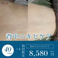 ご新規様★背中ケア★何を選んでいいかわからない方はこちら！