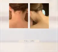 【東府中】後ろ姿&横顔美人♡うなじ+もみあげ脱毛