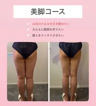 美脚コース〈ふくらはぎ・太もも・お尻 12,000円〉