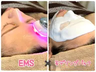 【たるみ・むくみ・小顔効果・乾燥改善✨】EMS幹細胞ポレーション導入+セラミド配合✨高保湿パック💖💖