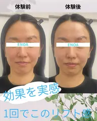 【1周年キャンペーン】人気No.1 輪郭矯正コルギ+ドライヘッドスパ ¥6,600