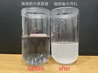 いちご鼻🍓6月限定 毛穴洗浄モニター募集