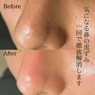 眉毛ワックス+鼻の毛穴洗浄