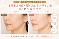 【40代からのたるみケア】ほうれい線・頬・フェイスラインをまとめて集中ケア