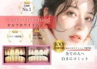 【口コミを書いていただける方限定クーポン】ホワイトニング9分×2セット3980円→500円★