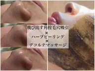 超お得【飛び出す角栓毛穴吸引+ハーブピーリング+デコルテマッサージ】¥11000