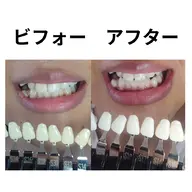 【紹介割】お友達に紹介してもらった方限定価格です!