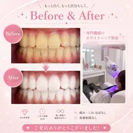 口コミを投稿頂ける会員の方はこちらからご予約ください◎¥0