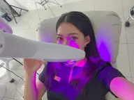 セルフホワイトニング