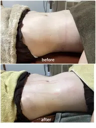 腸もみ