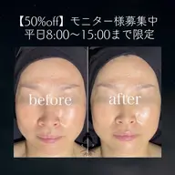 集まり次第終了 | モニター様募集| 50%off |平日8:00〜15:00枠限定🌙小顔リンパマッサージ