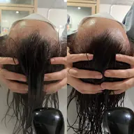 🫧🧴🧼ヘッドスパ🧴🧼🫧【⠀30分  】育毛・睡眠の質向上・リフトアップ小顔🍎