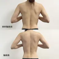 【慢性的な肩こり】骨格から変わる姿勢改善x首肩こりリセット150分コース　¥16,500
