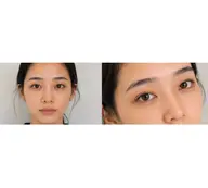 【垢抜け眉WAX】眉毛迷子の方はこちら🌿似合わせ眉で、洗練された雰囲気を🧚🏼‍♀️