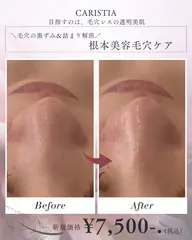 【超贅沢★目元も毛穴もケア】似合わせまつ毛パーマ + リアムールプレミアムパック15分✨姫路・東姫路
