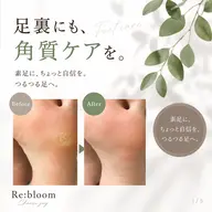 【足裏角質ケア】かかとのガサガサ・硬くなった足裏をなめらかに